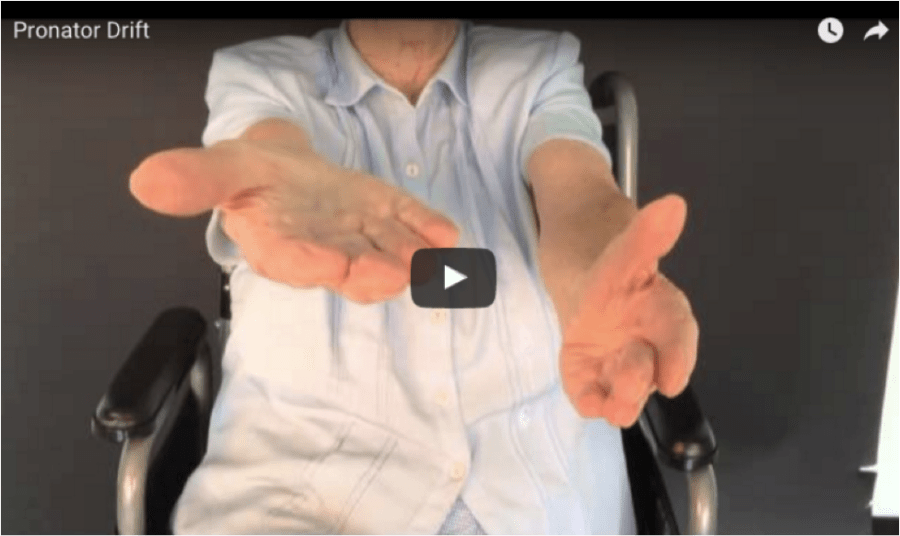 Article of The Week: Pronator&nbsp;Drift