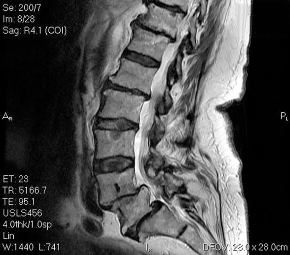 naiomt-lumbar-masterclass-mri-new